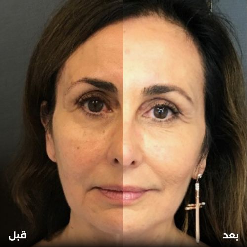 خلايا-جذعية-للوجه-والشعر